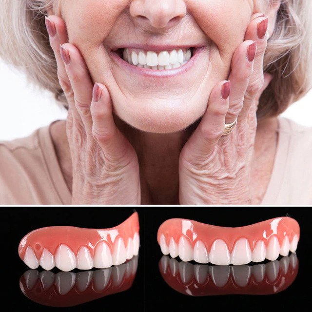 Great Smile Veneer (Upper & Lower) - 1 Set (Upper & Lower Veneers) - instant-smile-veneer