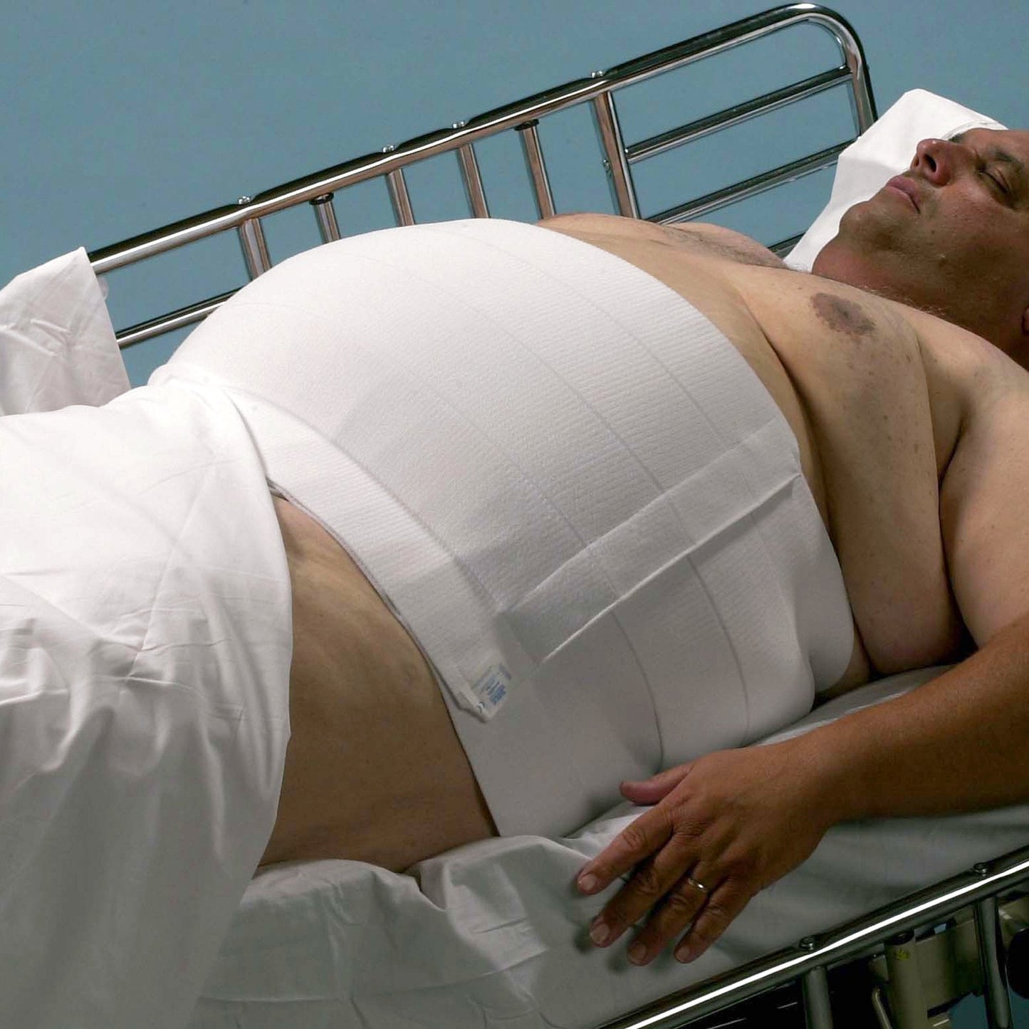 Abdominal Binder Dale Hook and Loop Closure 60 to 75 Inch Waist Circumference 12 Inch Height Adult, Packaging Type- Box