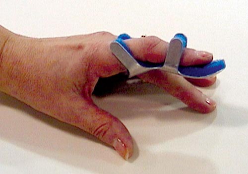 Toad Finger Splint Small Bulk PK/6 Non-Retail
