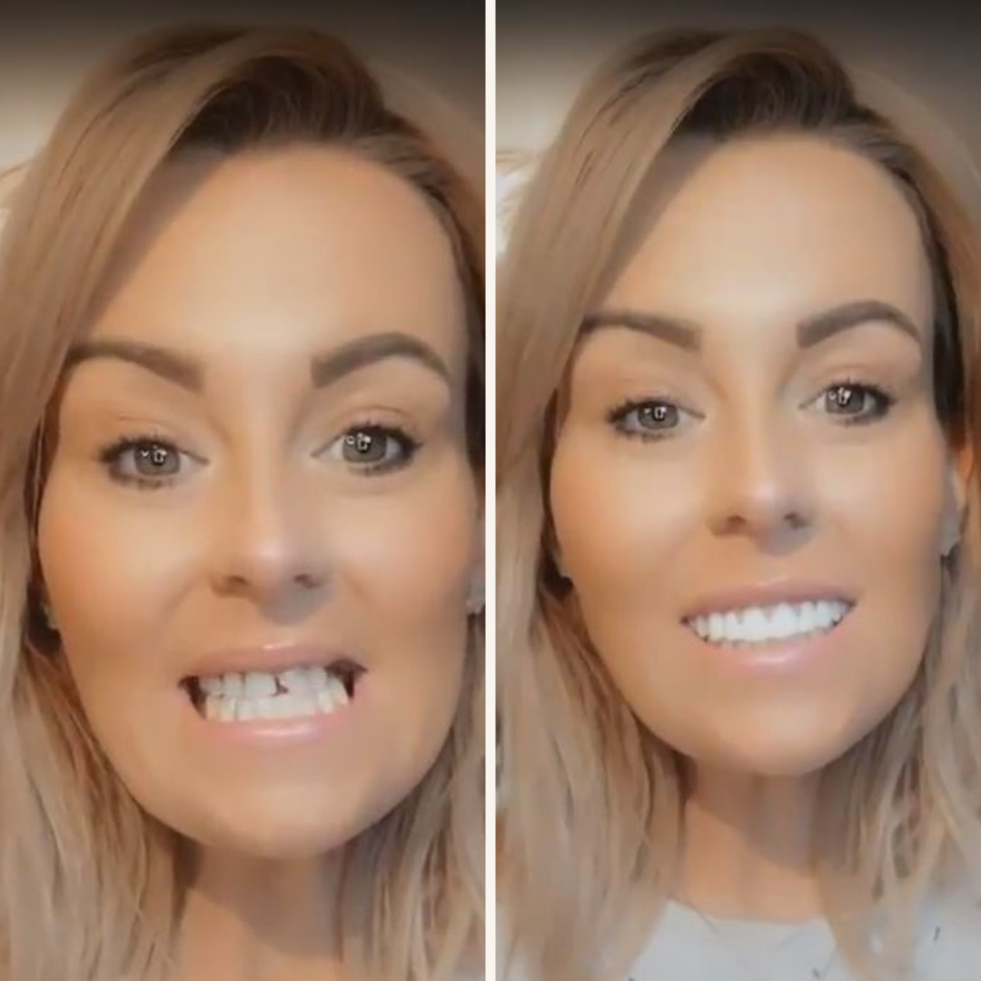 Instant Smile Comfort Fit Flex (Authentic Instant Smile)