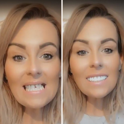 Instant Smile Comfort Fit Flex (Authentic Instant Smile)