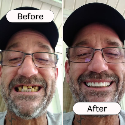 Instant Smile Comfort Fit Flex (Authentic Instant Smile)
