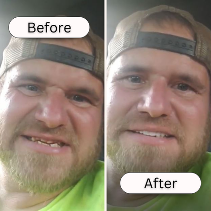 Instant Smile Comfort Fit Flex (Authentic Instant Smile)