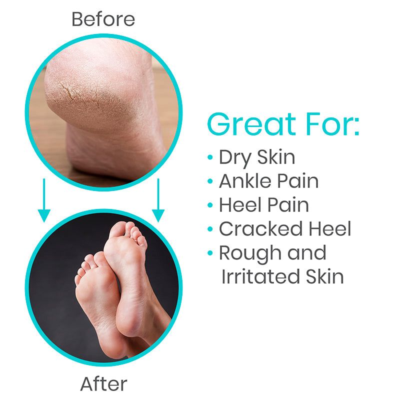 Moisturizing Socks - moisturizing-socks