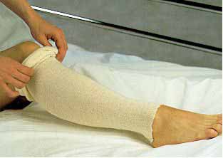 Stockinette Tubular Albahealth 3 Inch X 25 Yard Cotton NonSterile, Packaging Type- Each
